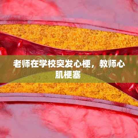老师在学校突发心梗,教师心肌梗塞