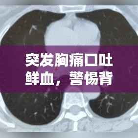 突发胸痛口吐鲜血,警惕背后隐藏的警示信号!
