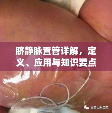 脐静脉置管详解,定义、应用与知识要点,百度带你探索医学新知
